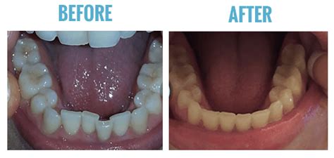 smile care club bad reviews.